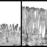 Normal microvilli