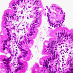 Parasites between mucosal folds