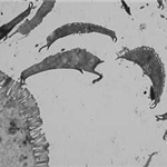 Electronmicroscopy picture of parasites