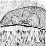 Electronmicroscopy picture of Giardia lamblia 