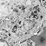 Clusters of microbes and lysosomes