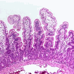 Normal light micrograph of small intestine