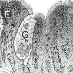 Normal epithelium of the small intestine
