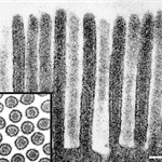 Microvilli of normal enterocyte cut